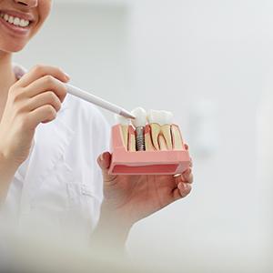 dentist pointing to a model of a dental implant in the jaw