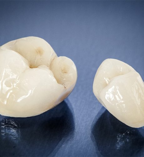 Two dental crowns