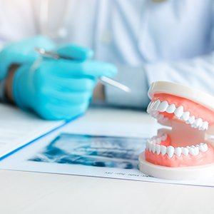 Model of teeth and X-ray lying on dentist's desk