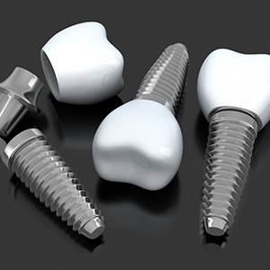 a 3D illustration of three dental implants with crowns and abutments