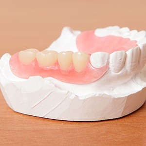 Model smile with partial denture