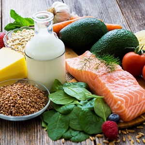 Assortment of healthy foods on a table