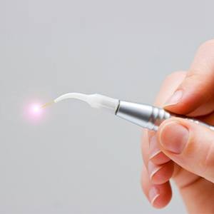 Hand holding soft tissue laser