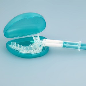 At-home teeth whitening kit