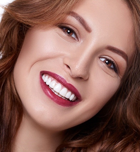 Woman with veneers in Betterdorf