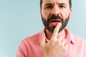 Man pointing to chapped lips.