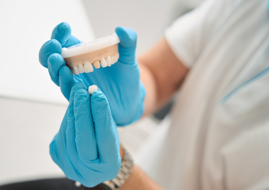 Dentist holding model dental crown